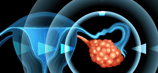 Langfristige Olaparib Erhaltungstherapie ist machbar