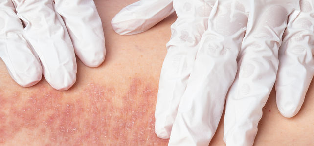 dsip nebenwirkungen Schmerzhafte diabetische Polyneuropathie zeitgem behandeln | Schmerzmedizin Du kennst das: Mde ins